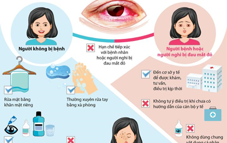 PHÒNG NGỪA ĐAU MẮT ĐỎ TẠI HỌC ĐƯỜNG